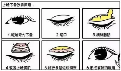 《眼睑》拼音/读音/英文/繁体