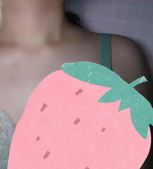 这两天肩膀那突然很痛,感觉斜方肌有点鼓起,想问一下姐妹们我现在的