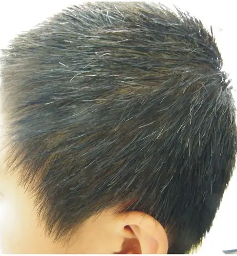 少年白发是早衰信号吗少年白发怎么办呢