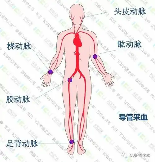 大部分正常人手部有来自于尺动脉的侧支循环,但部分患者可能缺乏侧支
