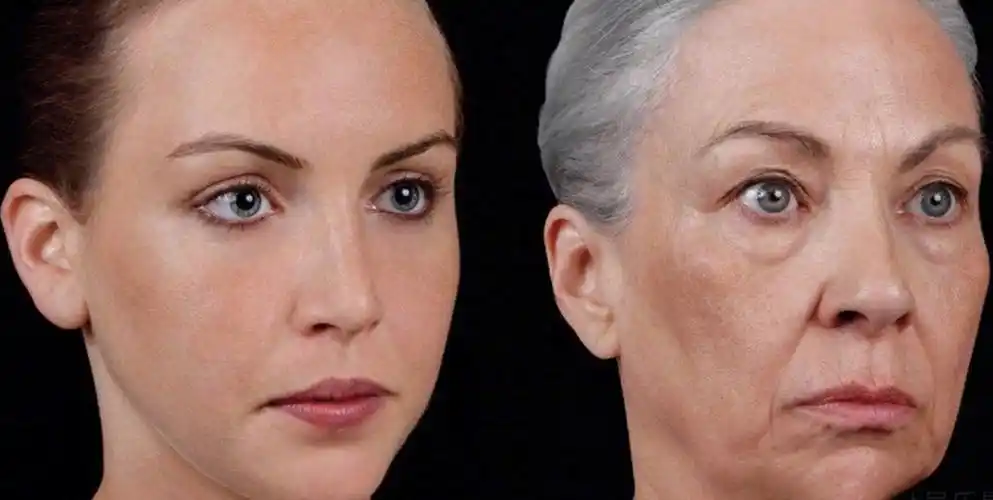 皮肤松弛_皮肤松弛缓解方法 - 好大夫在线