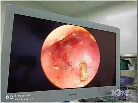 3岁女孩耳朵里藏了钻石真相让人大吃一惊