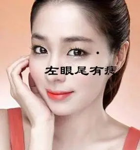 女人身上不能有的五颗痣,影响婚姻和财运,最好去掉