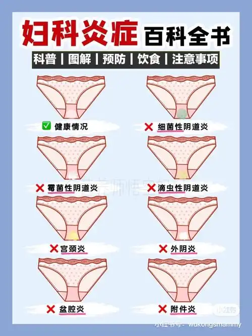 妇科疾病图片收集
