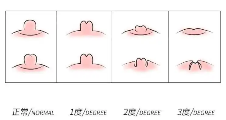 乳头内陷我还能做妈妈吗0101