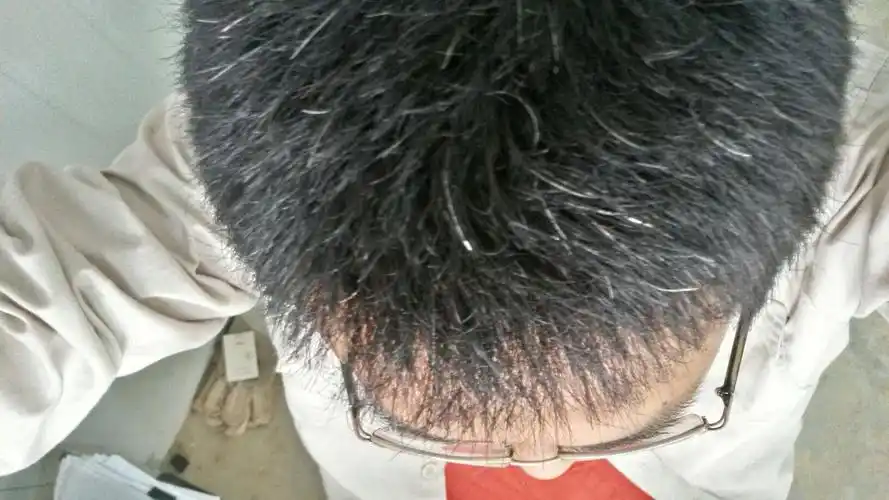 请问吃什么可以改变白头发(白发变黑发的最好方法食补白头发) - 医药