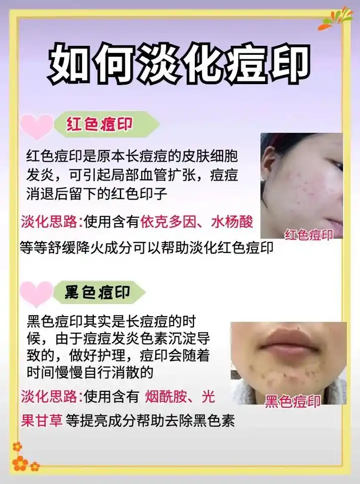 如何淡化痘印?内调外 - 抖音