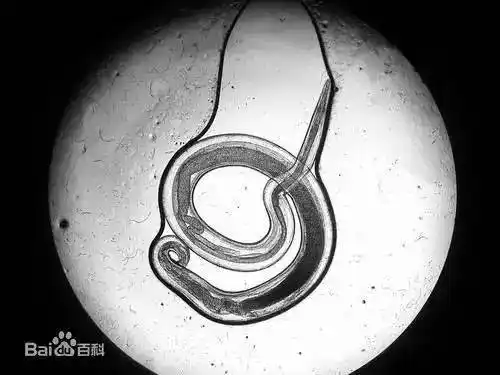 可怕!1岁宝宝眼睛里取出一条虫!稍不注意,人体内可能会养着这些虫.