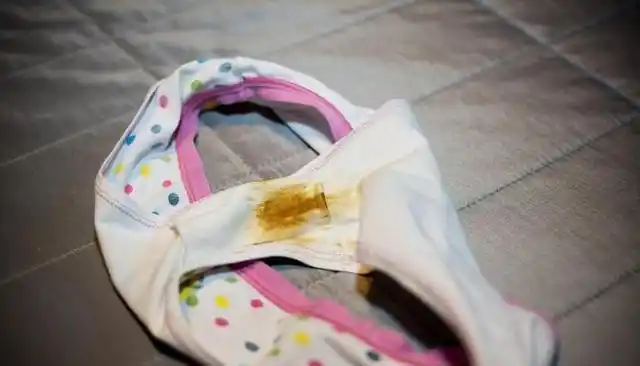 成蜂窝",一个不占,子宫还强壮|子宫肌瘤|白带|妇科炎症|囊肿_网易订阅