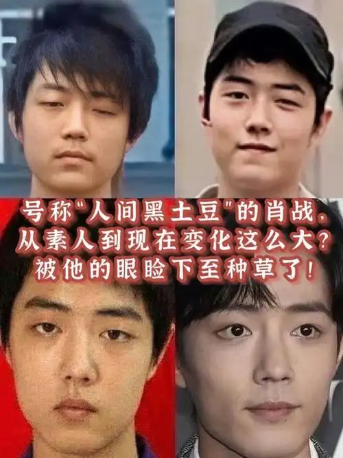 为什么肖战是土豆 - 实验室设备网