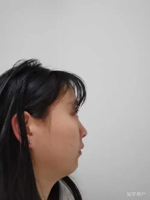 有一个超级扁平的侧脸是一种什么样的体验?