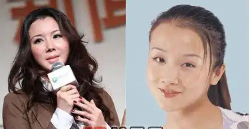演员孙菲菲个人资料,整容了吗 孙菲菲整容失败怎么回事