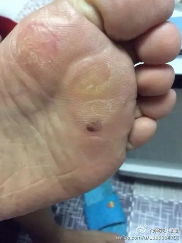 请问这是什么?女29岁?