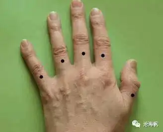 痣相手背上有痣代表含义