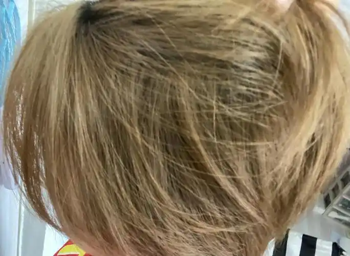 uu们漂过的头发褪色变黄了要怎么护理呐