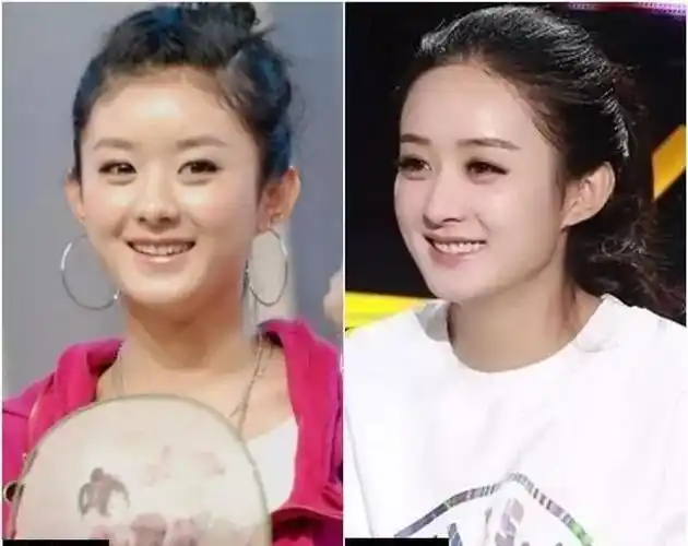 赵丽颖整容史!今天带你扒一扒