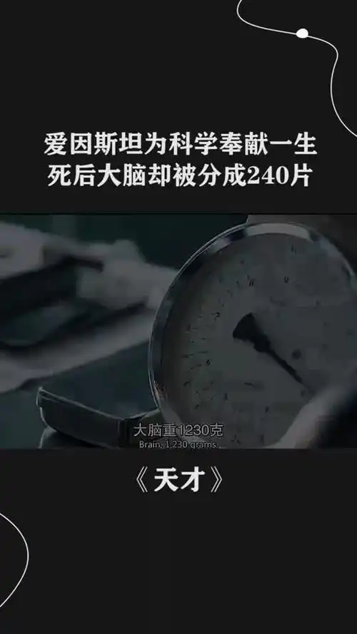 爱因斯坦为科学奉献一生,死后大脑却被分成240片