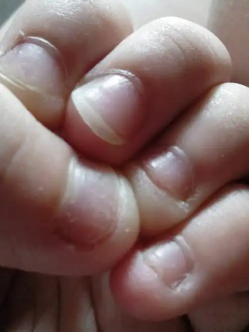 女孩子咬指甲 长成了这样怎么办 女生的手是不是很重要 这么丑咬成了