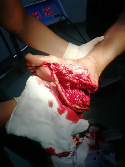 小城故事的美篇