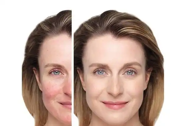 这样强制性过度护肤不敏感才怪呢.