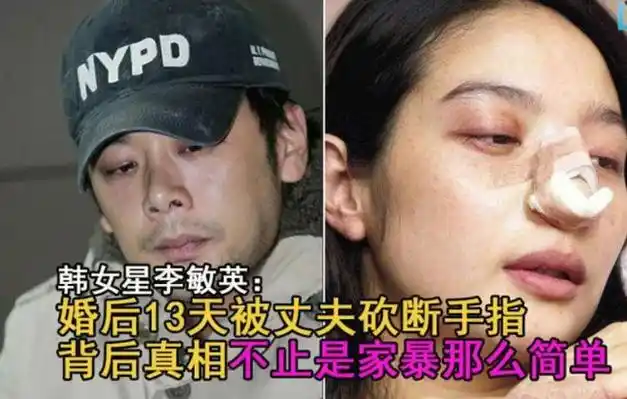 被传家暴,毁容后,林志玲首度公开发声:被"期待"的不幸