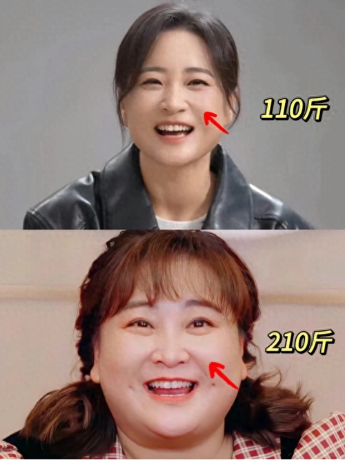 贾玲减肥100斤冲上热搜!看似不起眼的艾灸竟然也能减肥?