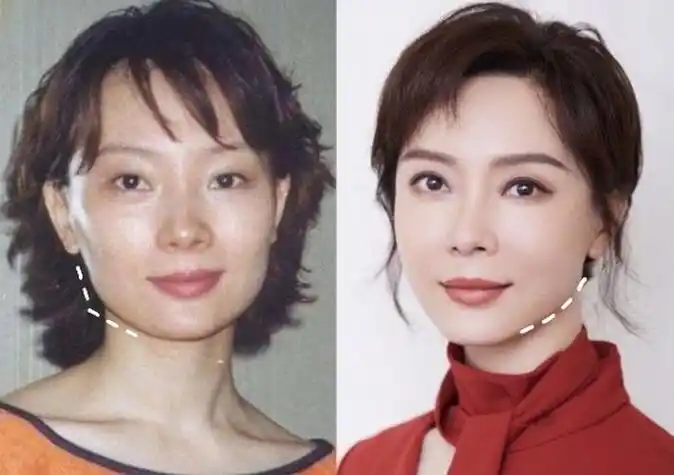 陈数靠脸逆天改命 长得"歪瓜裂枣",整的"美若天仙"是真的吗?