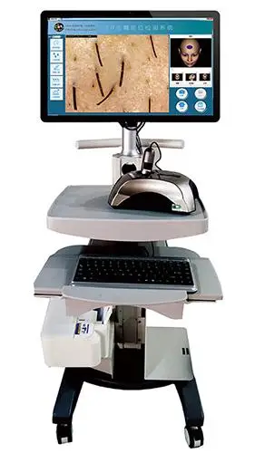 台湾cbs皮肤镜影像检测系统