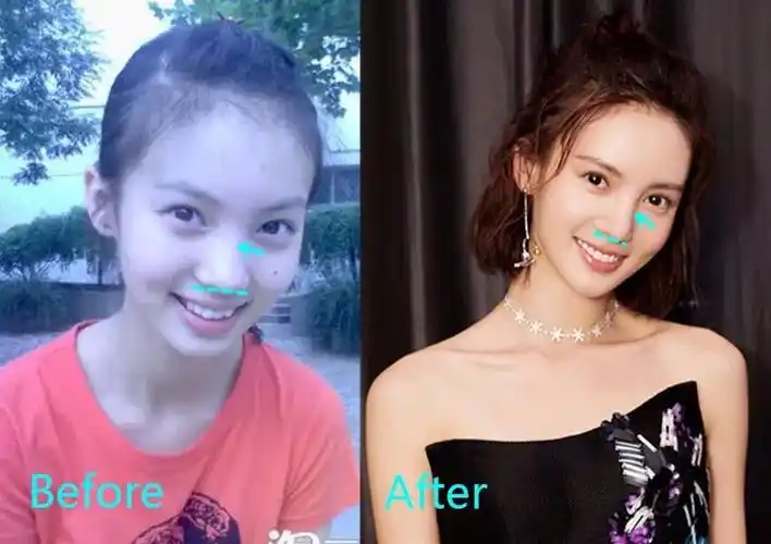 金晨状告唐人违约败诉,公司不捧她的原因是.