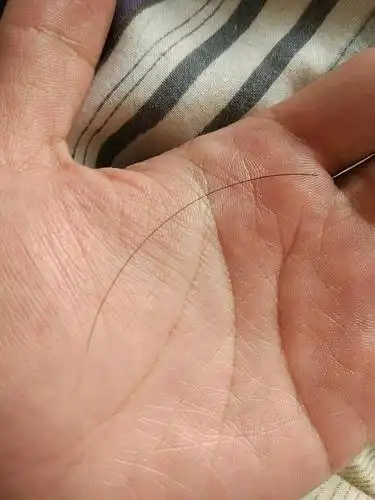 发根长出黑发 上面白下面黑