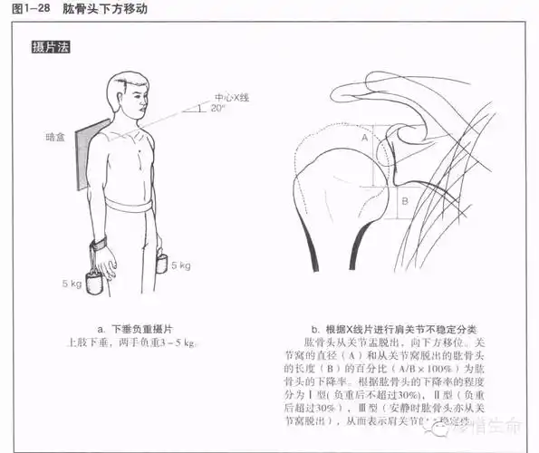 肩关节x线检查体位大全