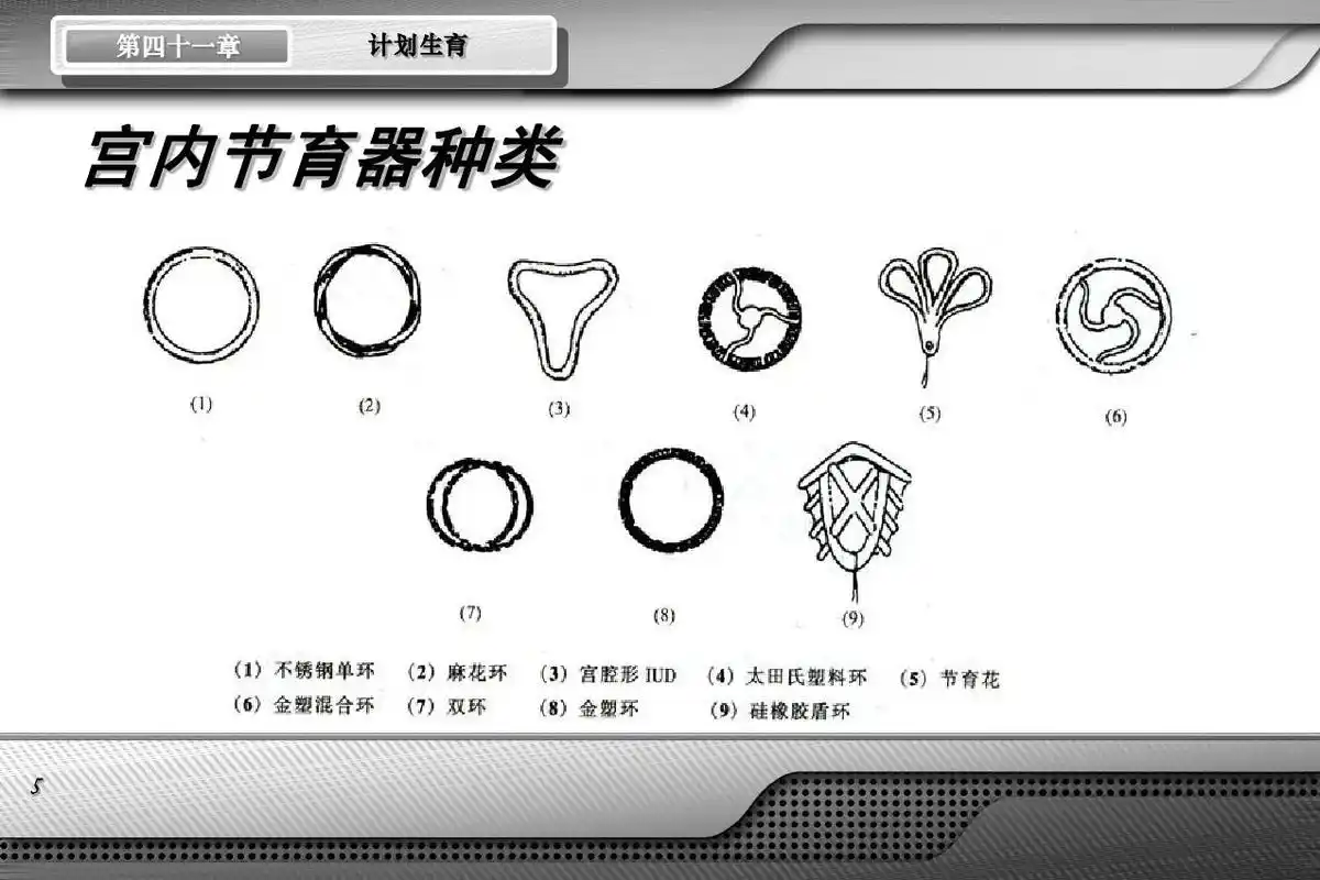 第四十一章 计划生育 宫内节育器种类