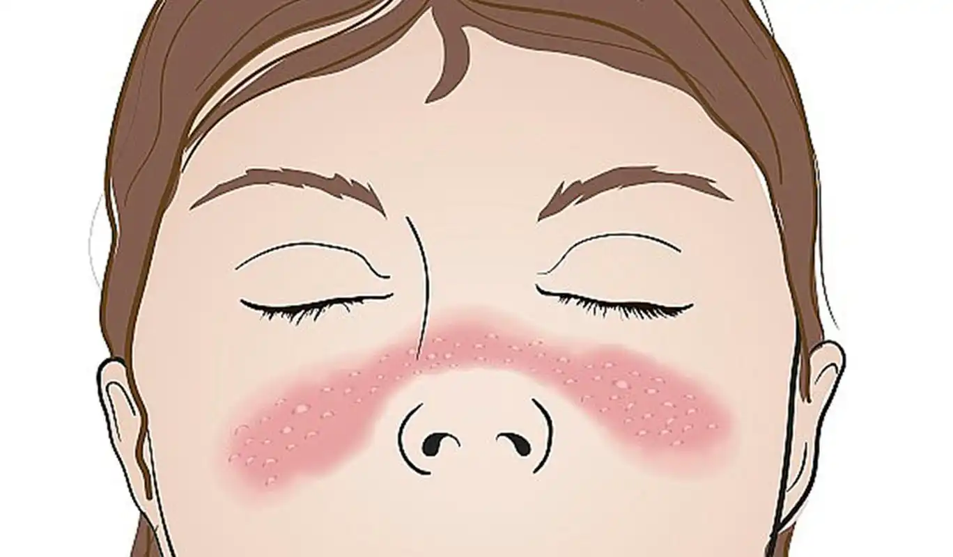 毛孔收缩与类型及原因有关.