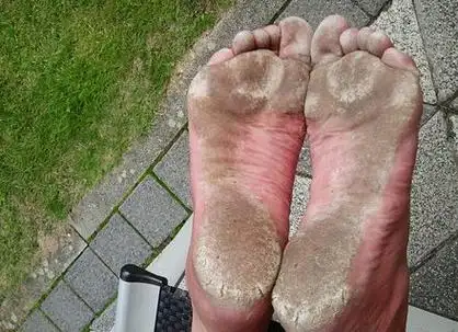 p data-id="gnzzvwavyw">赤脚,又称"光脚","