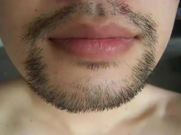 男性胡子长得快是怎么回事提醒这个3时间段尽量别刮胡子