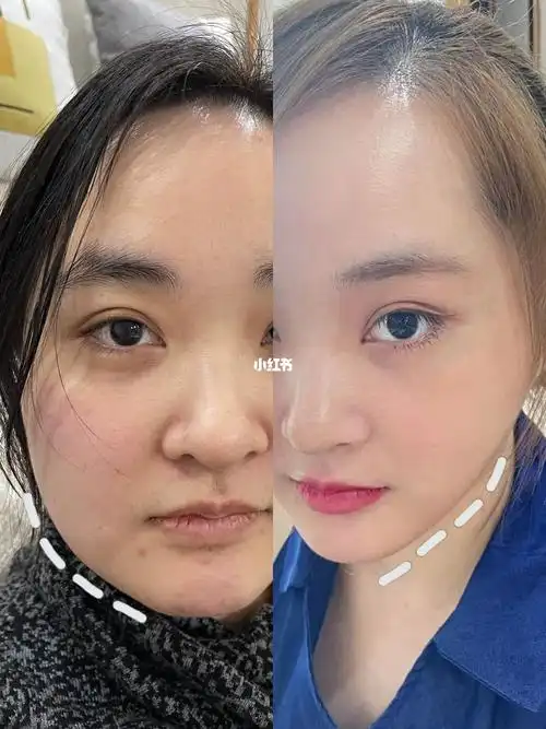 一直以来对我的大饼脸耿耿于怀!