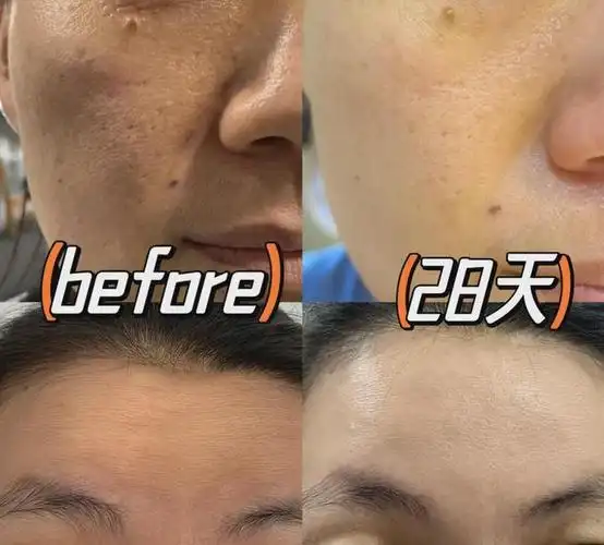 在高铁上发现了一个秘密|美白|色斑|面霜|抗老|胶原蛋白_网易订阅