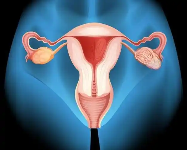 这5类食物会加速女性子宫衰老若爱吃坚持这项运动或能改善