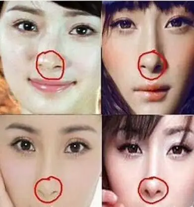 杨幂整容了吗杨幂整容前后照片曝光