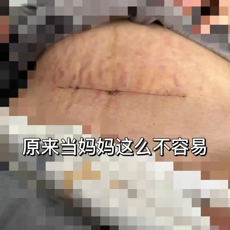 长这么大我做过最勇敢的事,就是剖腹八层与你见面 - 抖音