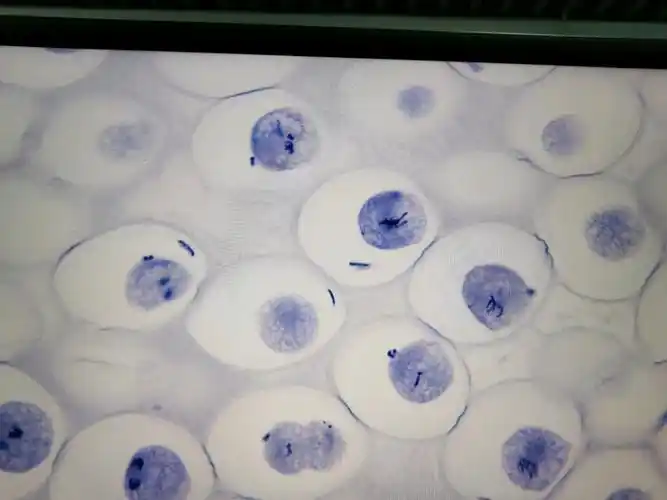 马蛔虫有丝分裂观察