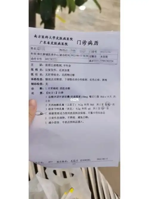 广州皮肤科闭口粉刺