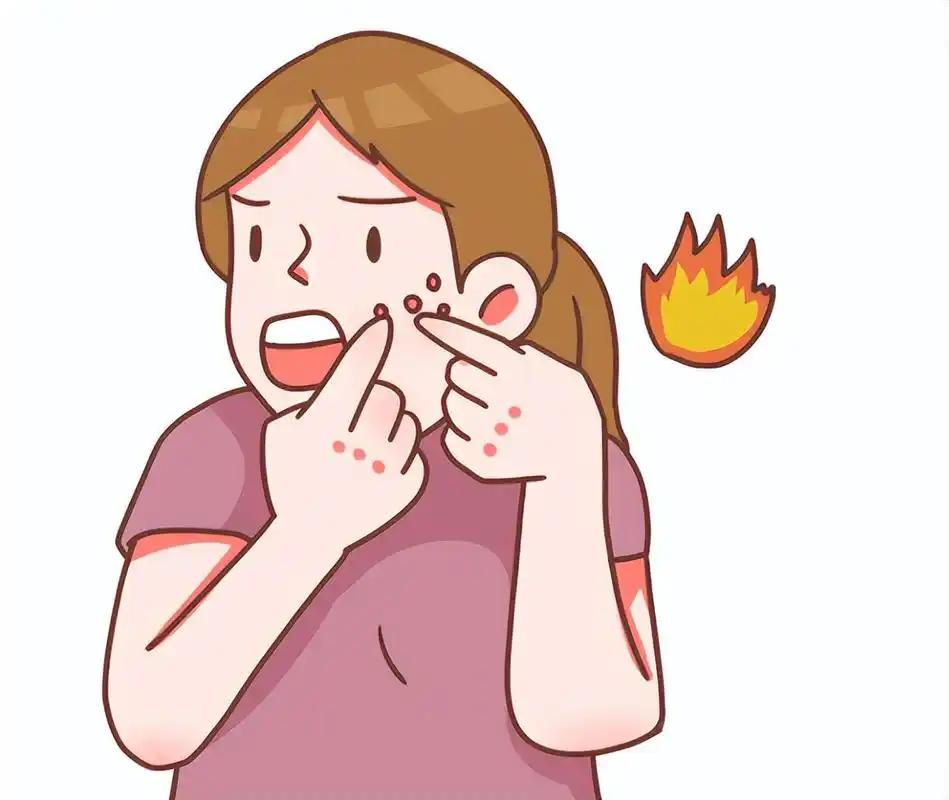 痘痘,闭口为什么总找上你?真相原来如此简单