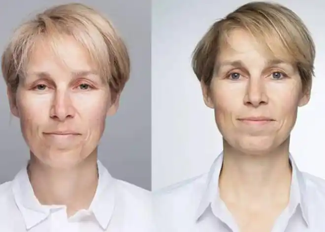 熬夜对皮肤有多少影响?晚睡晚起就不会影响皮肤?