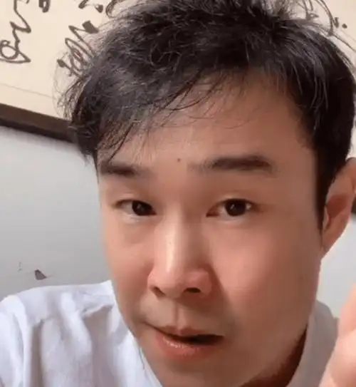 39岁的小沈阳这是咋了?面容沧桑头发稀疏,显露"秃顶"前兆