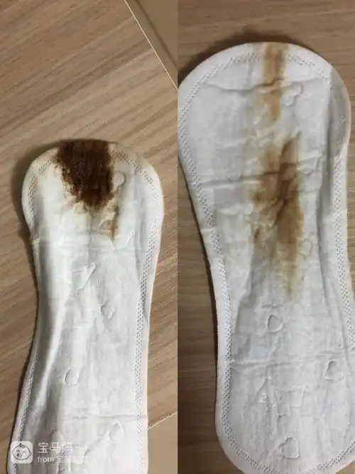 早孕褐色分泌物(有图)