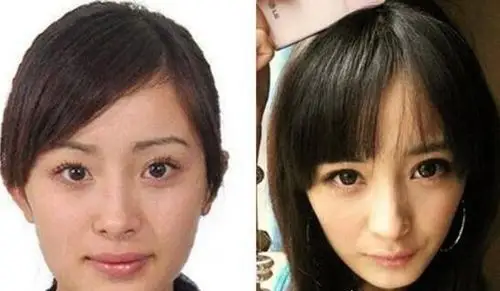 杨幂整容前后照片对比整容失败留下后遗症曝光