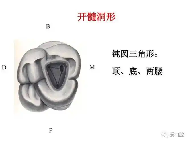 盘点磨牙开髓的方法_医生_影响_孩子