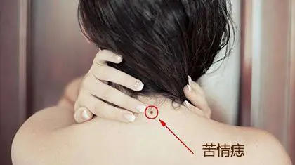 苦情痣的人命运怎么样 有什么含义