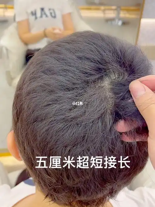 广州接发广州羽毛接发广州无痕接发超短发接长这是一位头发只有五厘米